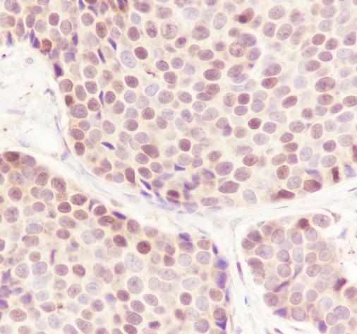 Recombinant CBX4 Monoclonal Antibody-searchlist-3