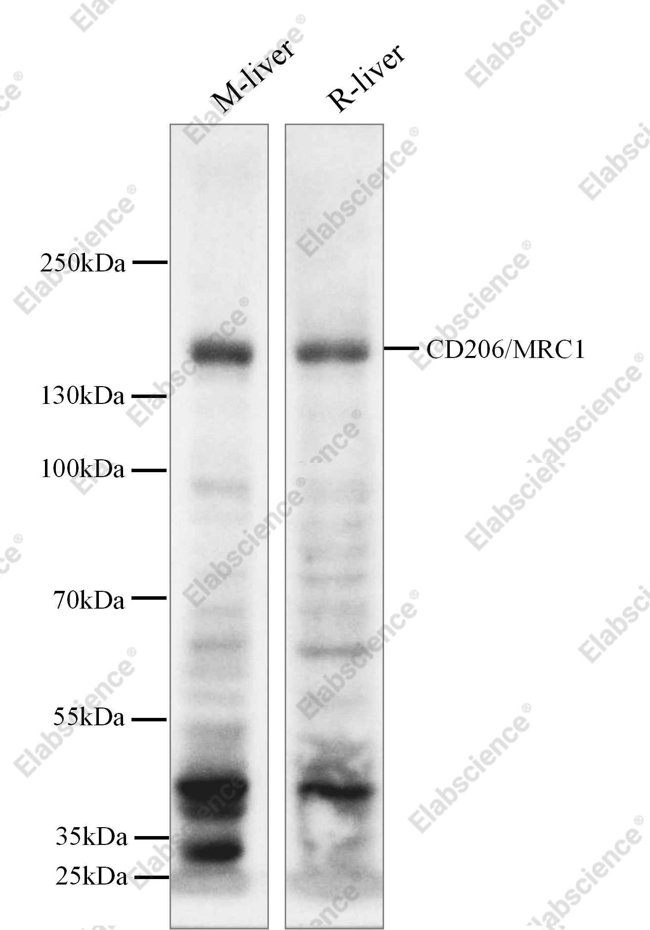 Recombinant CD206/MRC1 Monoclonal Antibody - 1