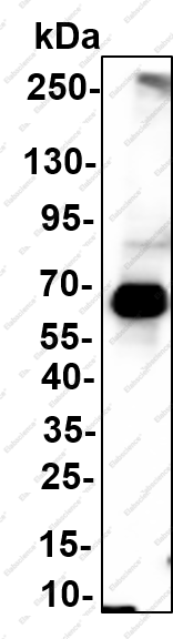Recombinant METTL14 Monoclonal Antibody - 1