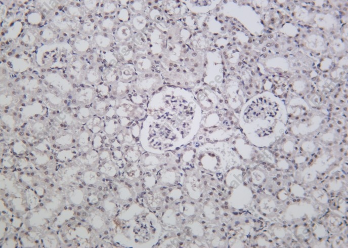 Recombinant BRD4 Monoclonal Antibody - 1