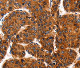 HSP75 Polyclonal Antibody - 2