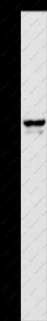 APOL1 Polyclonal Antibody - 1