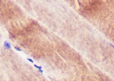 Recombinant Ryanodine Receptor Monoclonal Antibody-searchlist-1