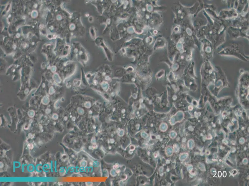 OE19 Cell Complete Medium - small - 6