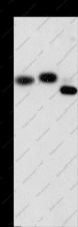 CAPZA2 Polyclonal Antibody - 1
