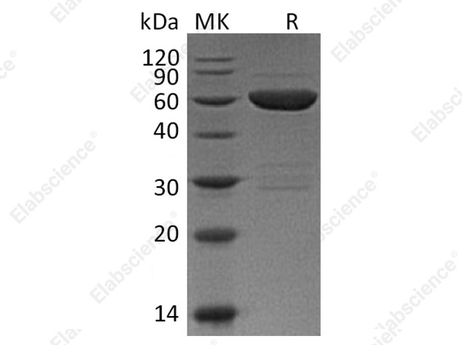 Recombinant Mouse Galectin 9/LGALS9 Protein (GST Tag) - 1