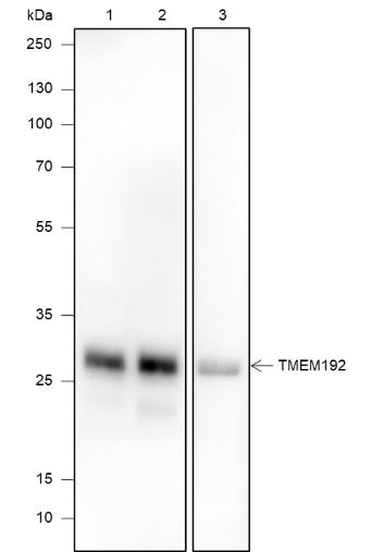Recombinant TMEM192 Monoclonal Antibody-searchlist-1