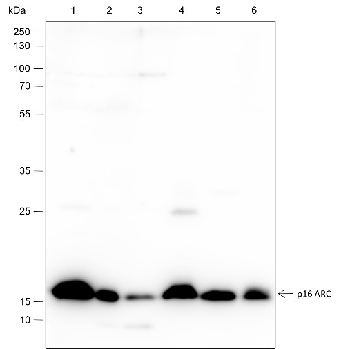 Recombinant ARPC5/p16 ARC Monoclonal Antibody-searchlist-1