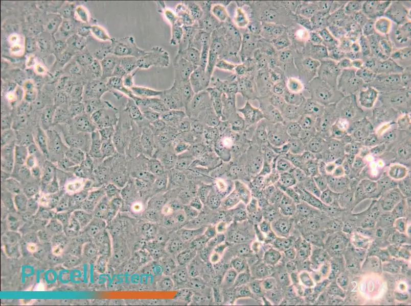 B-CPAP [BC-PAP; BCPAP] Cell Complete Medium - small - 6