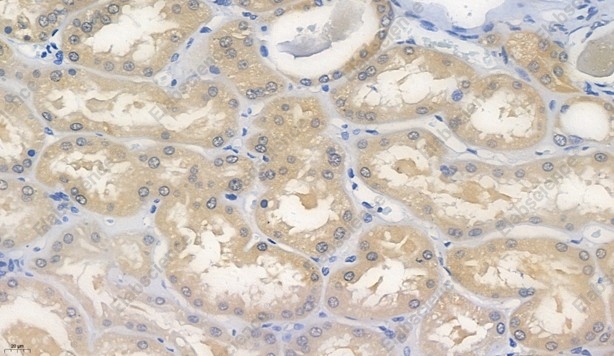 Recombinant Glutathione Peroxidase 4 Monoclonal Antibody - 4