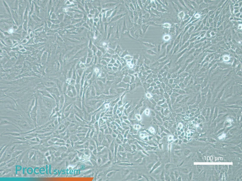 Hela - 1