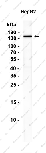 Recombinant NPC1L1 Monoclonal Antibody - 1