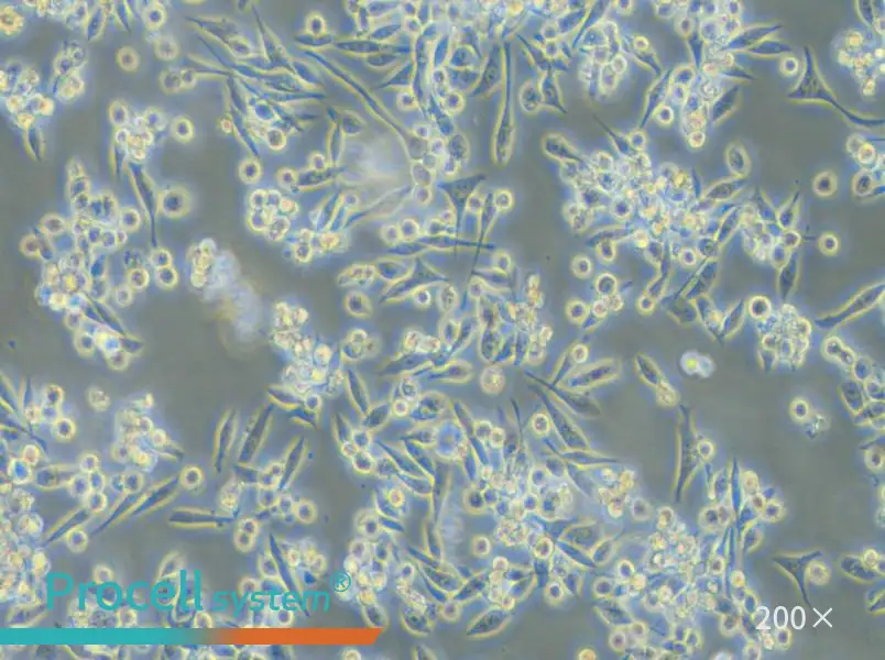 MKN-45 Cell Complete Medium - small - 5