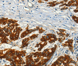 ADCY3 Polyclonal Antibody - 2