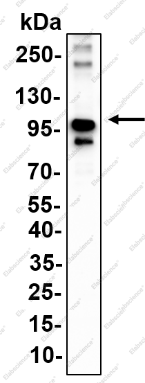 Recombinant TFE3 Monoclonal Antibody - 1