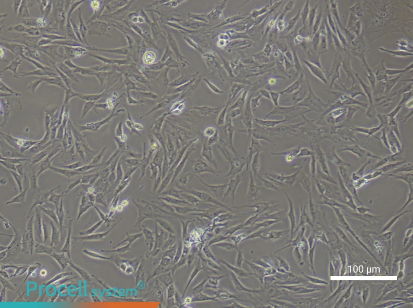 Rat Trabecular Meshwork CellsRat Trabecular Meshwork Cells - 3
