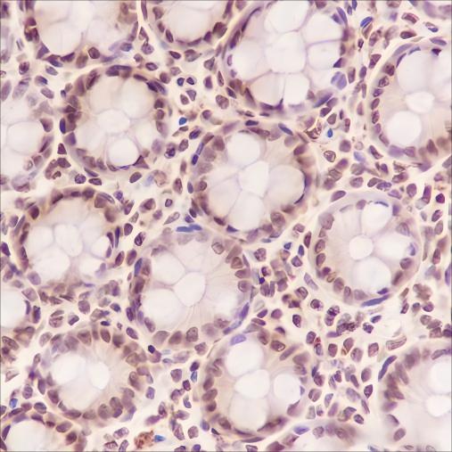 Recombinant COPS3 Monoclonal Antibody - 2