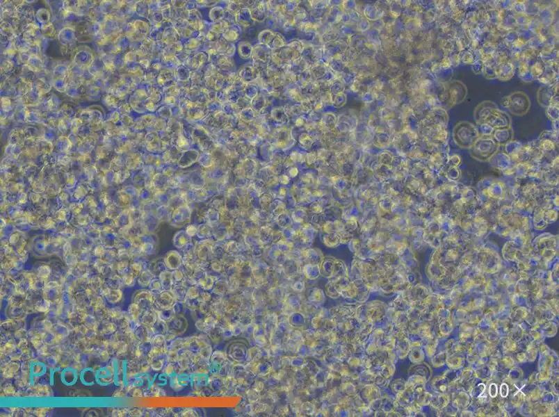 HuT 78 Cell Complete Medium - small - 5