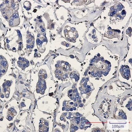 Recombinant ARPC5/p16 ARC Monoclonal Antibody - 2