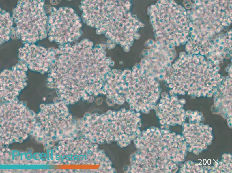 HuT 102 Cell Complete Medium - 6