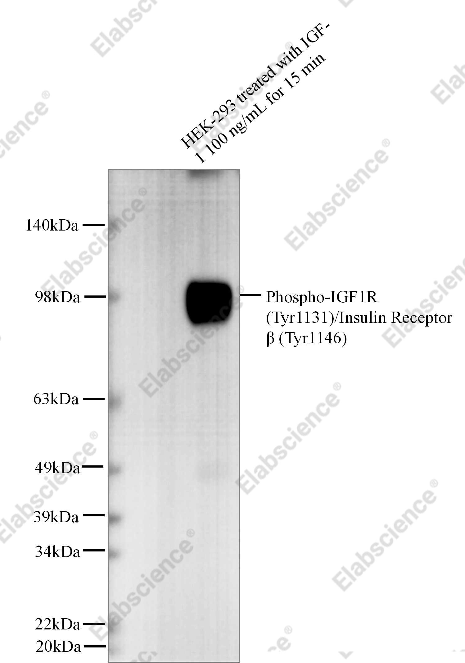 Recombinant Phospho-IGF1R (Tyr1131)/Insulin Receptor β (Tyr1146) Monoclonal Antibody - 1