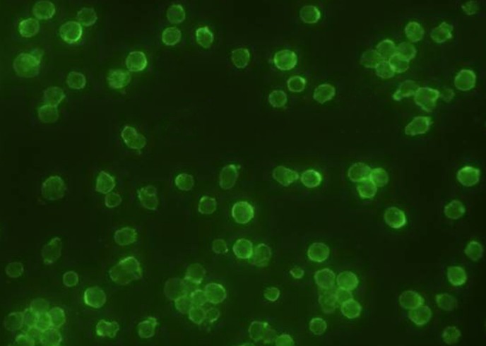 CD45/PTPRC Monoclonal Antibody - small - 2