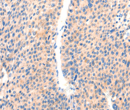 PAFAH2 Polyclonal Antibody - 2