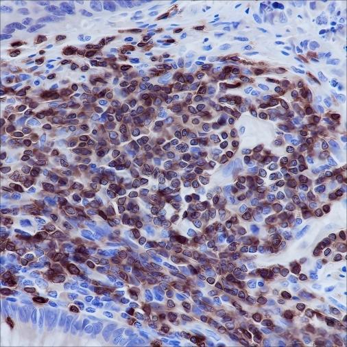 Recombinant CD3 epsilon Monoclonal Antibody - small - 3