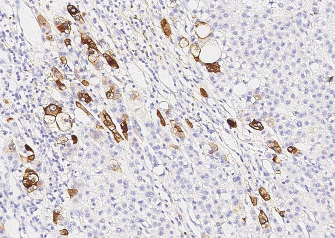 KRT19 Monoclonal Antibody - small - 3