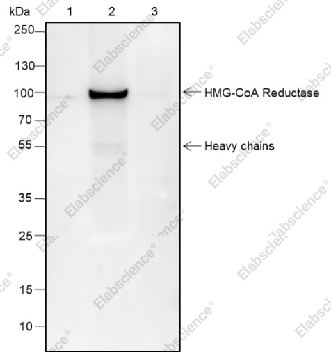 Recombinant HMGCR Monoclonal Antibody - 4