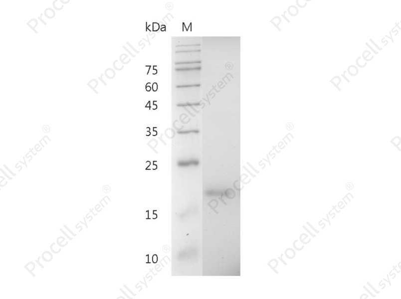 IL-33/IL-1 F11/NF-HEV, Mouse, Recombinant