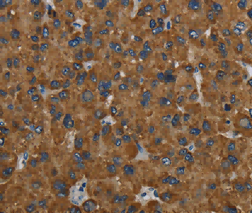 PCK2 Polyclonal Antibody - 2