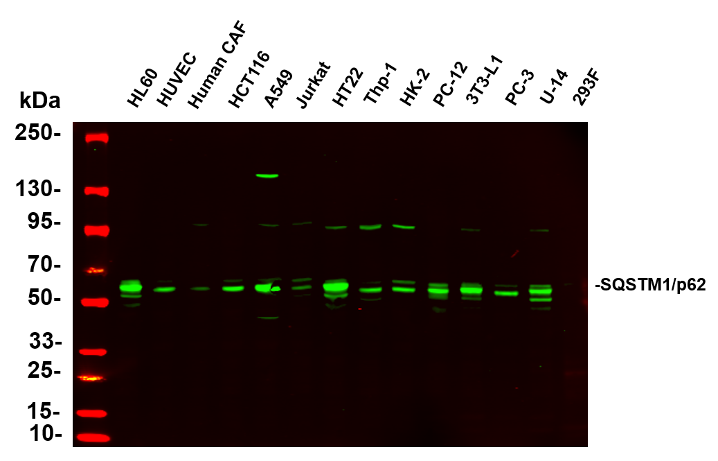 Recombinant SQSTM1/p62 Monoclonal Antibody - 3
