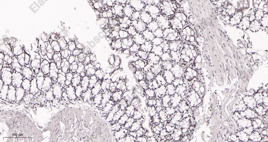 Recombinant SP1 Monoclonal Antibody - 3