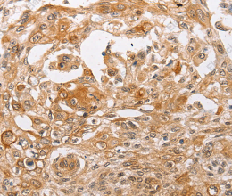 PPP1CB Polyclonal Antibody - 3