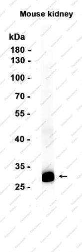 Recombinant Calbindin Monoclonal Antibody - 1