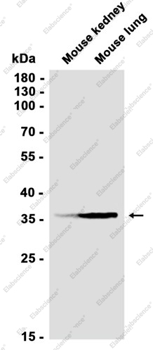 Recombinant Annexin 4 Monoclonal Antibody - 2