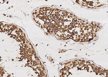 RUVBL1/RVB1 Monoclonal Antibody - small - 2