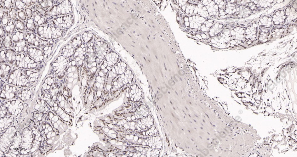 Recombinant KDM1A Monoclonal Antibody - 2