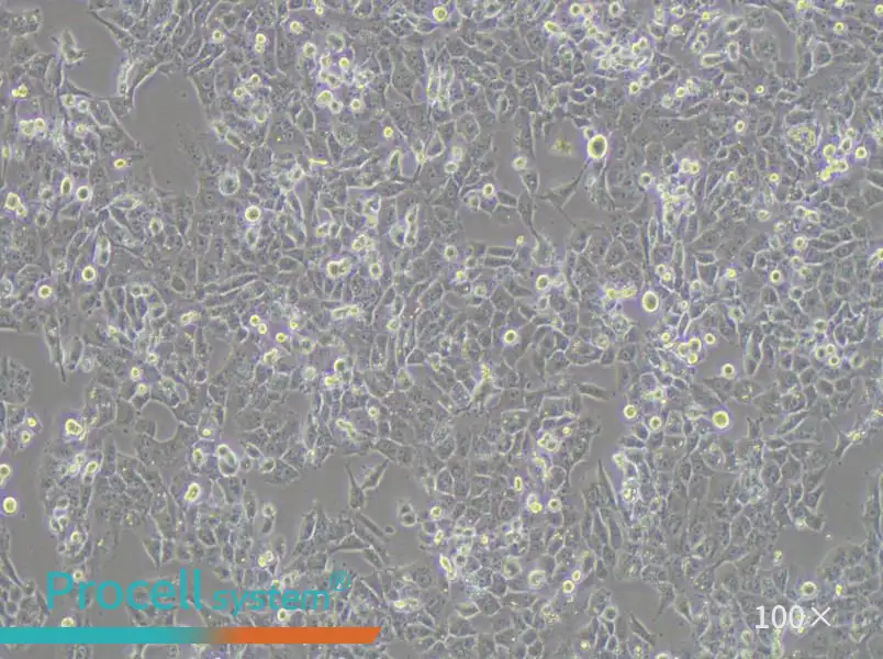 NCI-H1915 Cell Complete MediumNCI-H1915 Cell Complete Medium - 2