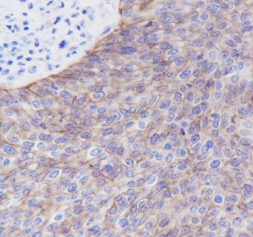 Recombinant Claudin-1 Monoclonal Antibody - small - 4