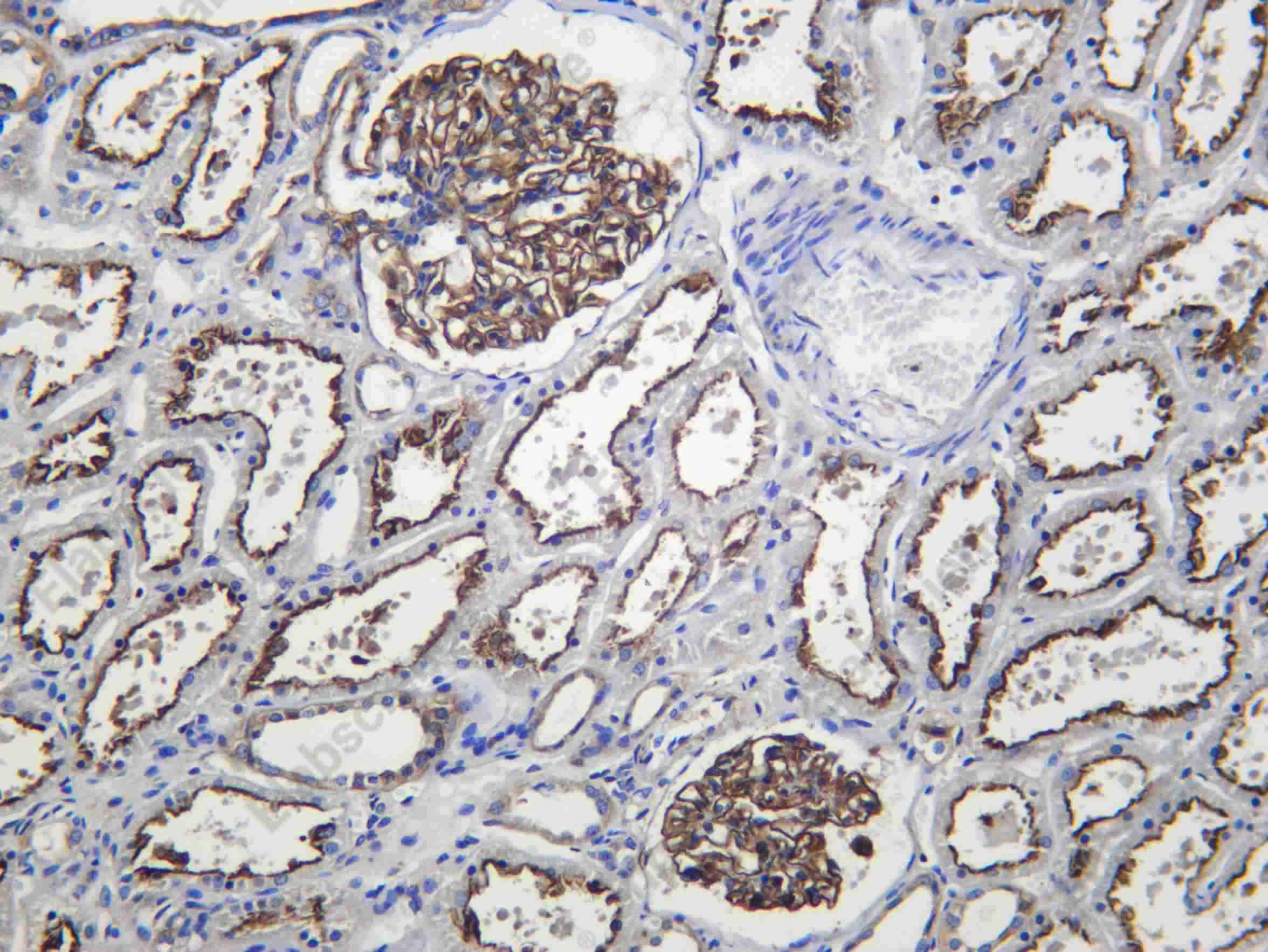 Recombinant ACTN4 Monoclonal Antibody - 1