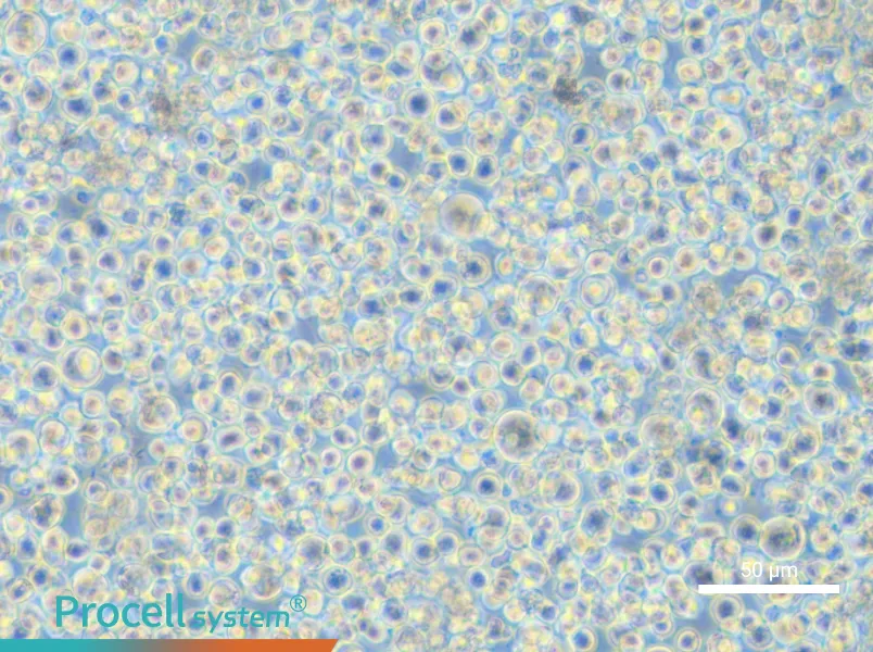 SET-2 Cell Complete Medium - 5