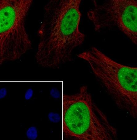 Recombinant ATF1 Monoclonal Antibody - small - 6