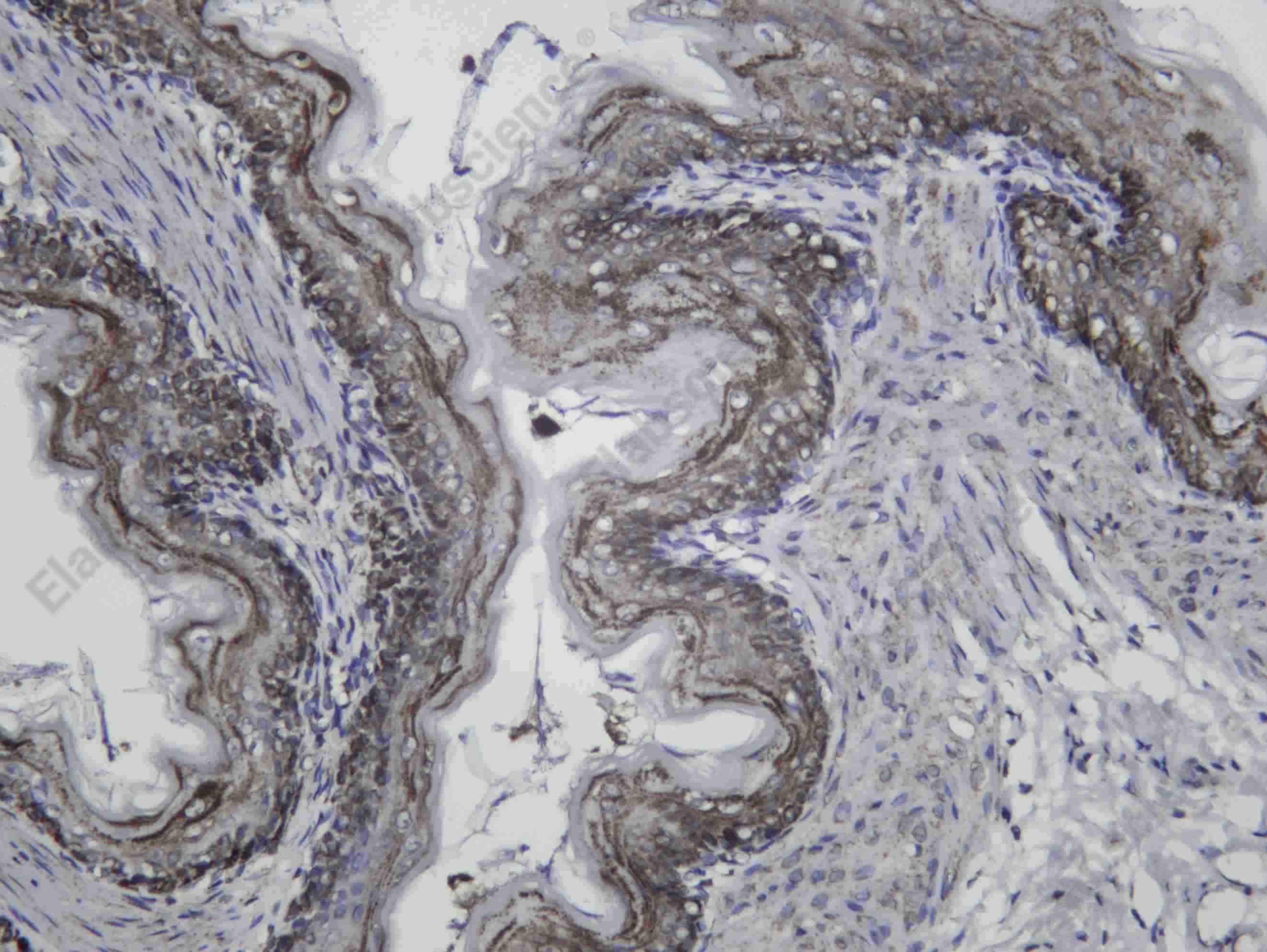 Recombinant MCAD Monoclonal Antibody - 3