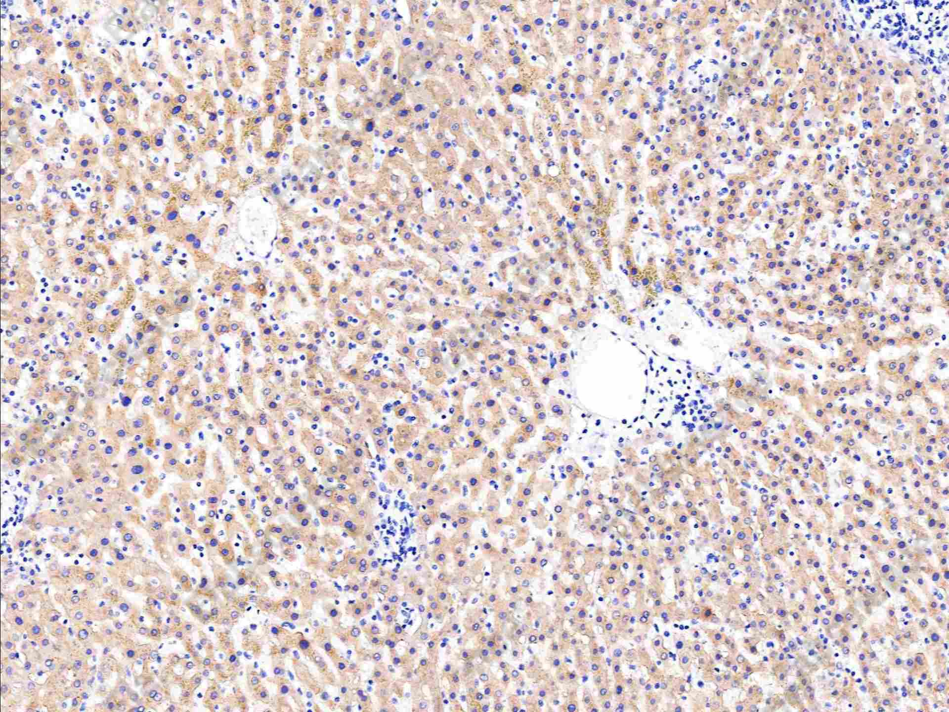 Recombinant ASGR2/ASGPR2 Monoclonal Antibody - 1