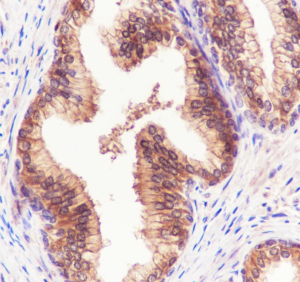 Recombinant ATP Citrate Lyase Monoclonal Antibody - 3