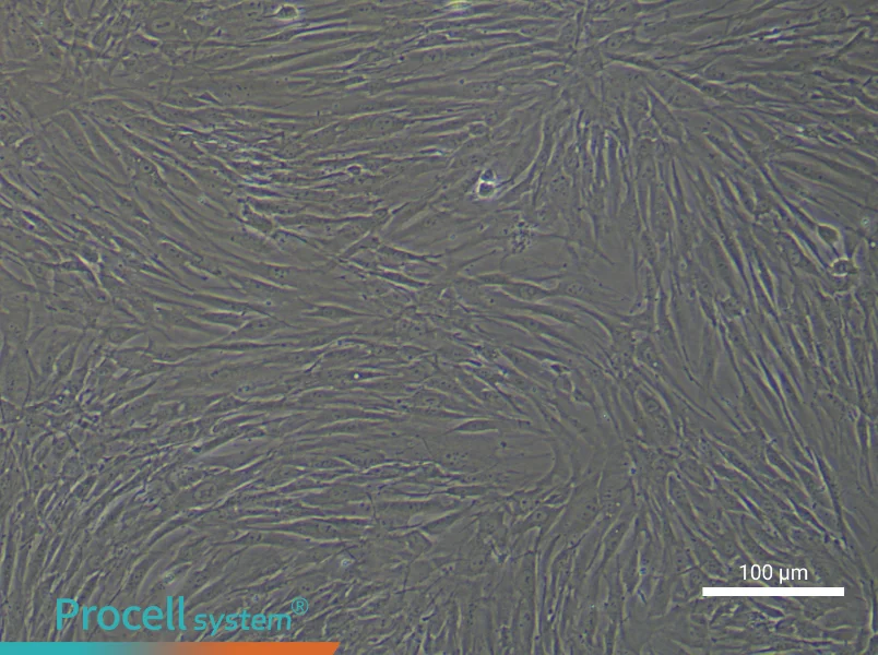 Human Esophageal Cancer Fibroblast Complete Medium - 1