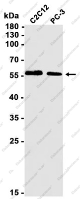 Recombinant PRPF31 Monoclonal Antibody - 1