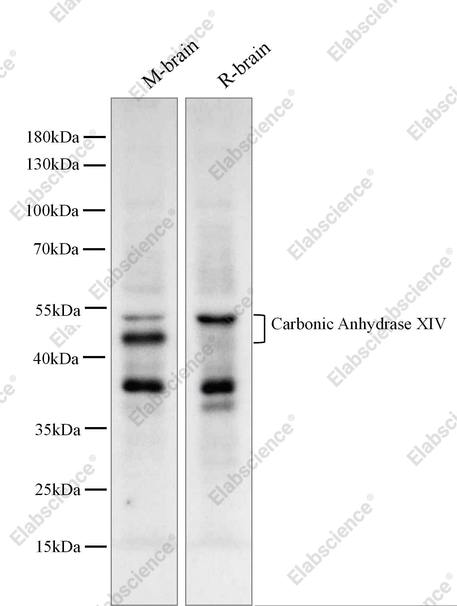 Recombinant Carbonic Anhydrase XIV/CA14 Monoclonal Antibody - 1